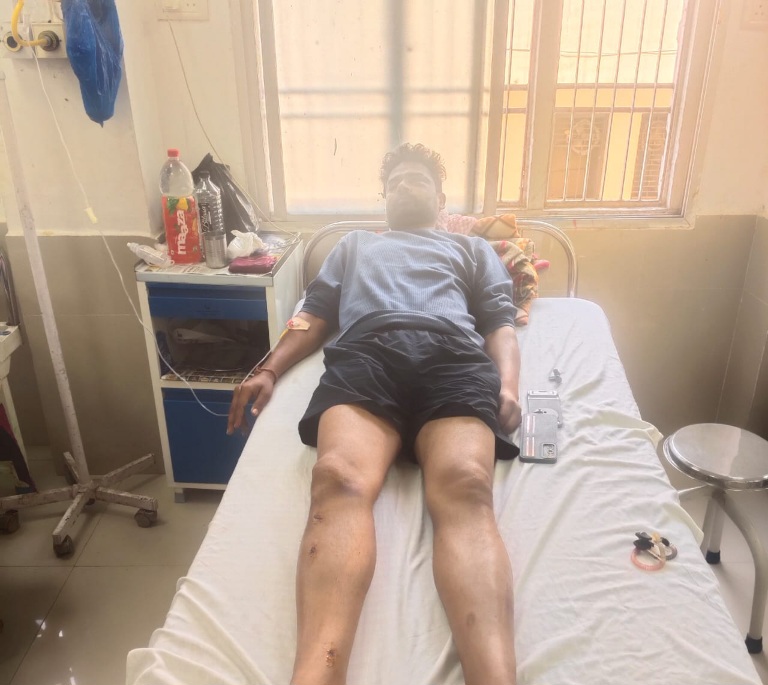 सीपत , चखना सेंटर में विवाद, मारपीट में आर्मी जवान समेत तीन लोग घायल।